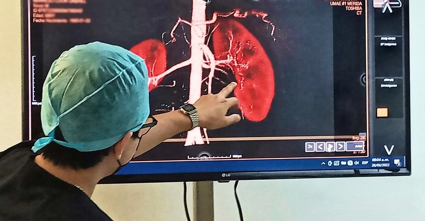 PREVENGA A TIEMPO LOS CÁLCULOS RENALES